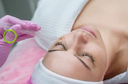Chemical Peels
